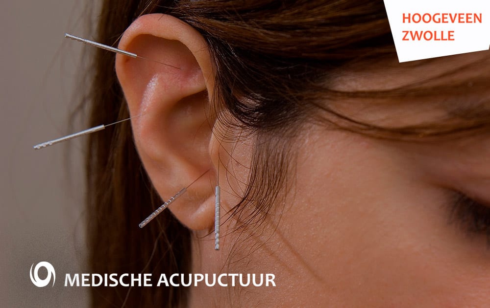 website design acupunctuur hoogeveen